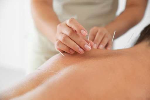 Five Ways Acupuncture Can Help Your Health And Wellness