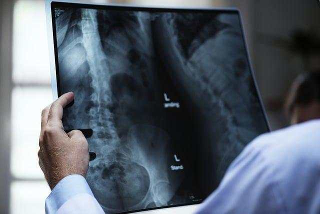 What Is Microdecompression Spine Surgery?