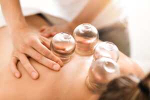 cupping therapy