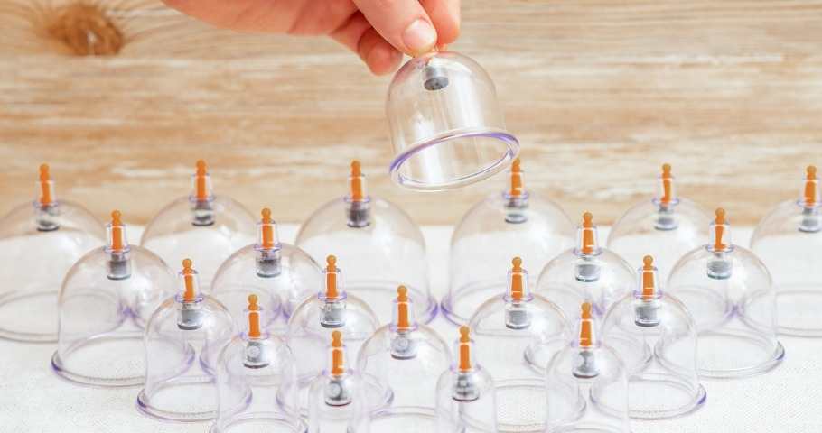 What Is Cupping Therapy And Who Should Use It?