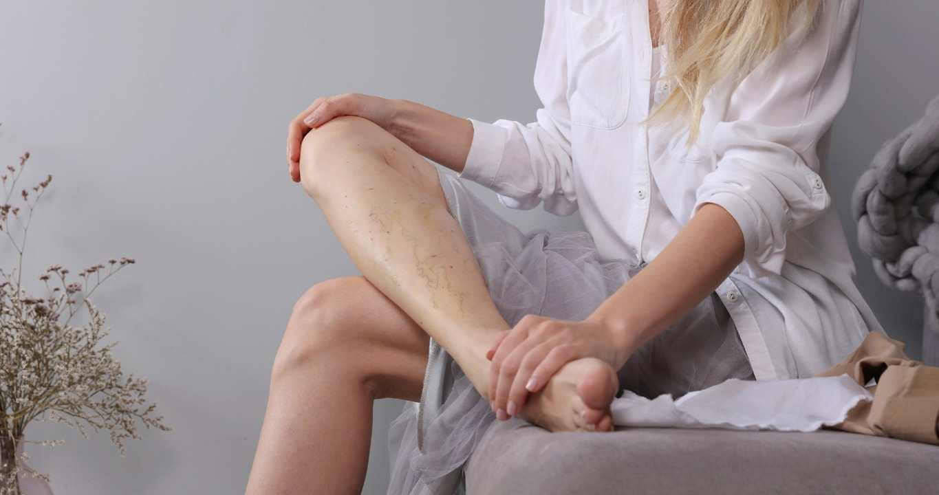 How To Treat Venous Insufficiency At Alliance Orthopedics
