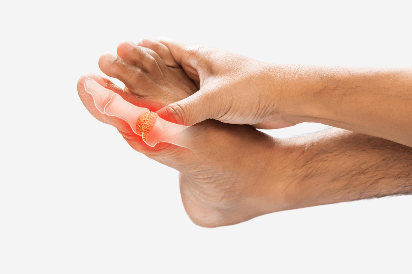 Alliance Orthopedics’ Approach To Inflammatory Arthritis: Minimizing Pain, Maximizing Mobility