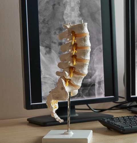 Orthopedic Spine Care