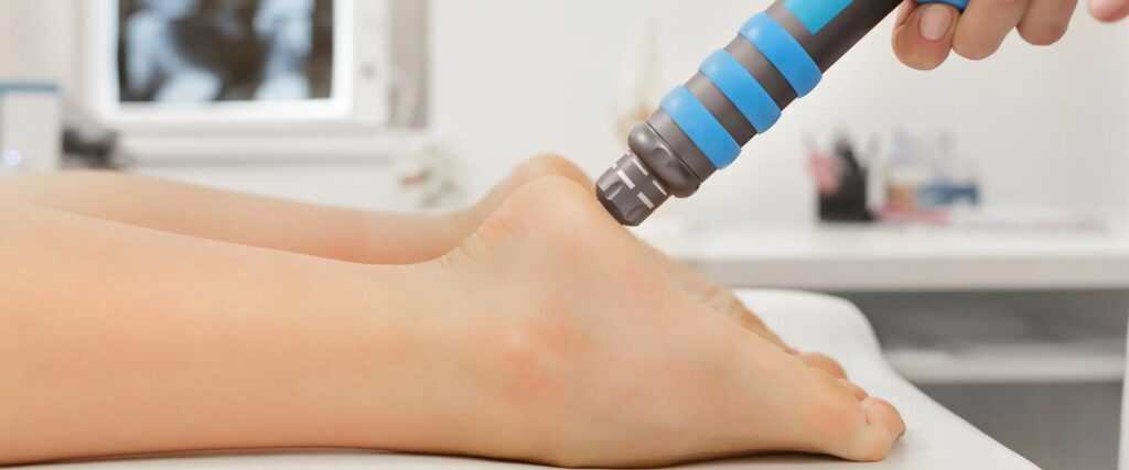 Shockwave Therapy for Plantar Fasciitis: A Breakthrough Approach to Chronic Pain Relief