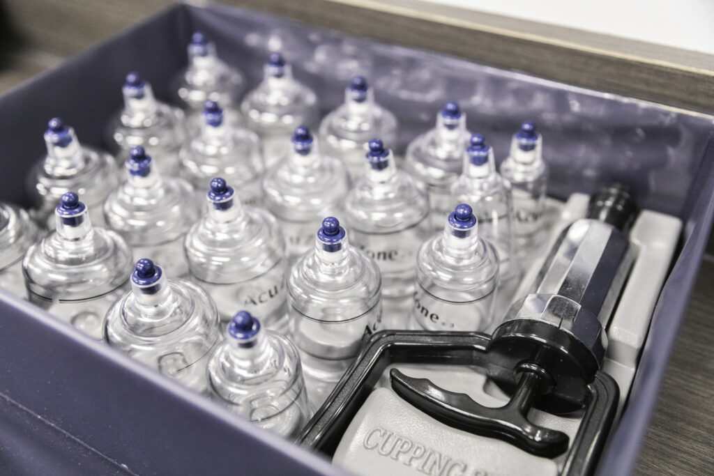 Cupping Therapy