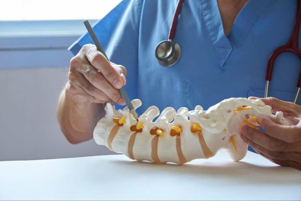 Revision Spine Surgery A Minimally Invasive Option for Faster Recovery